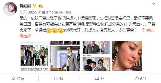 蒋勤勤脸颊通红浮肿 发文:吓着大家了,求轻喷