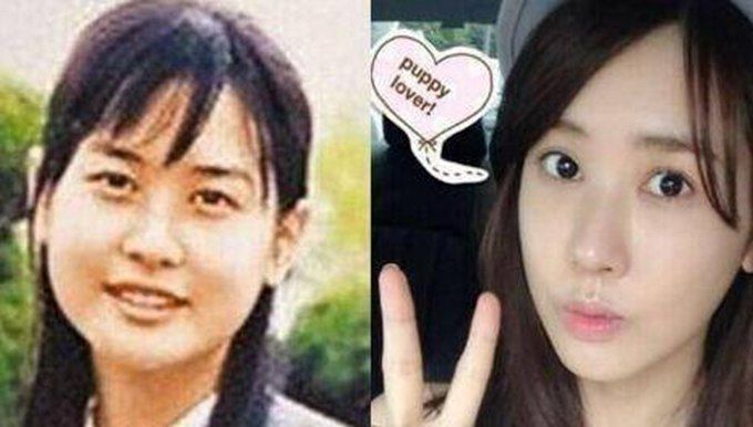 韩国女星疑似整容规模第一名竟是她 变化之大令人惊叹：像换了一个人？